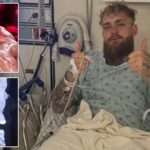 Jake Paul in hospital bed with a broken jaw.