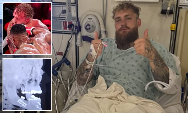 Jake Paul in hospital bed with a broken jaw.